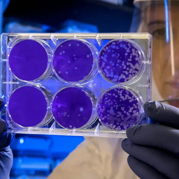 Woman observing cell development in vials