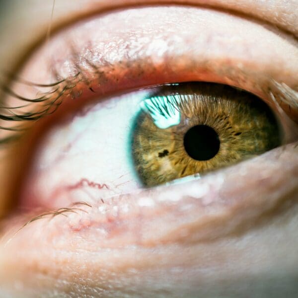 Close up of green eye with visible capillaries