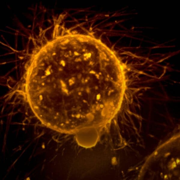 A stem cell..