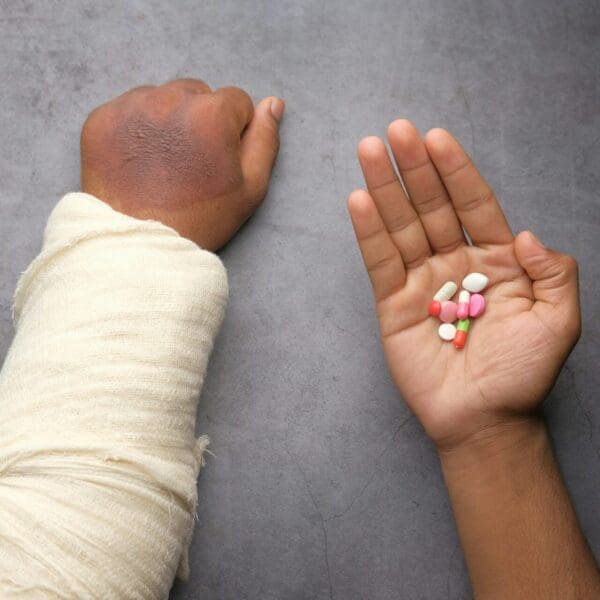 Two hands against a gray background: one in a white cast and the other holding multiple pills.